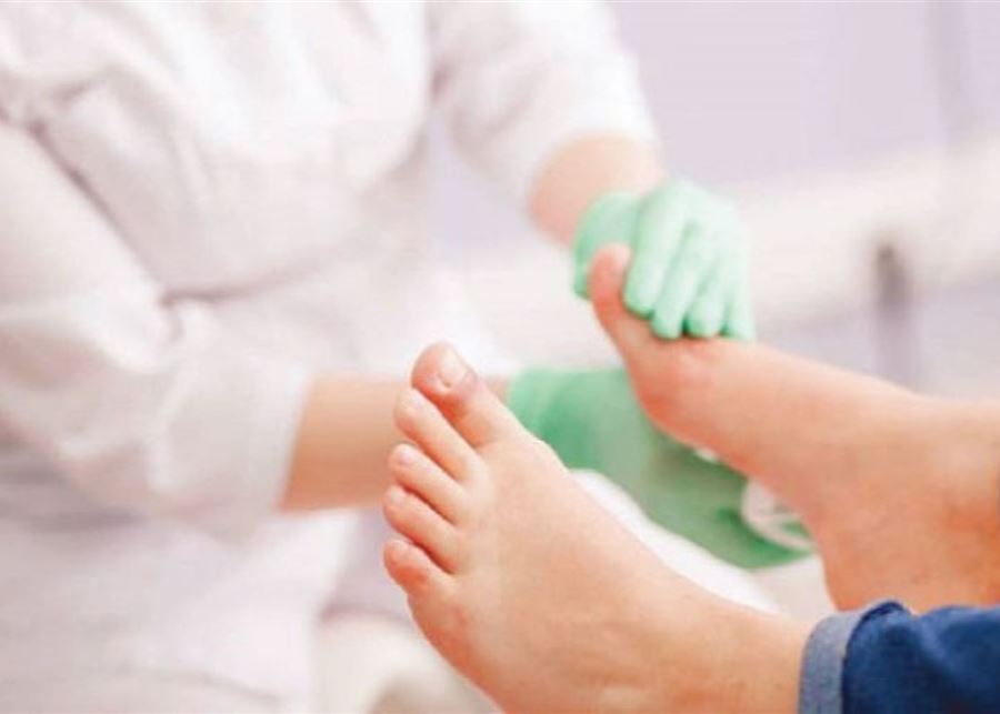 أمراض تكشفها علامات على أصابع قدميك