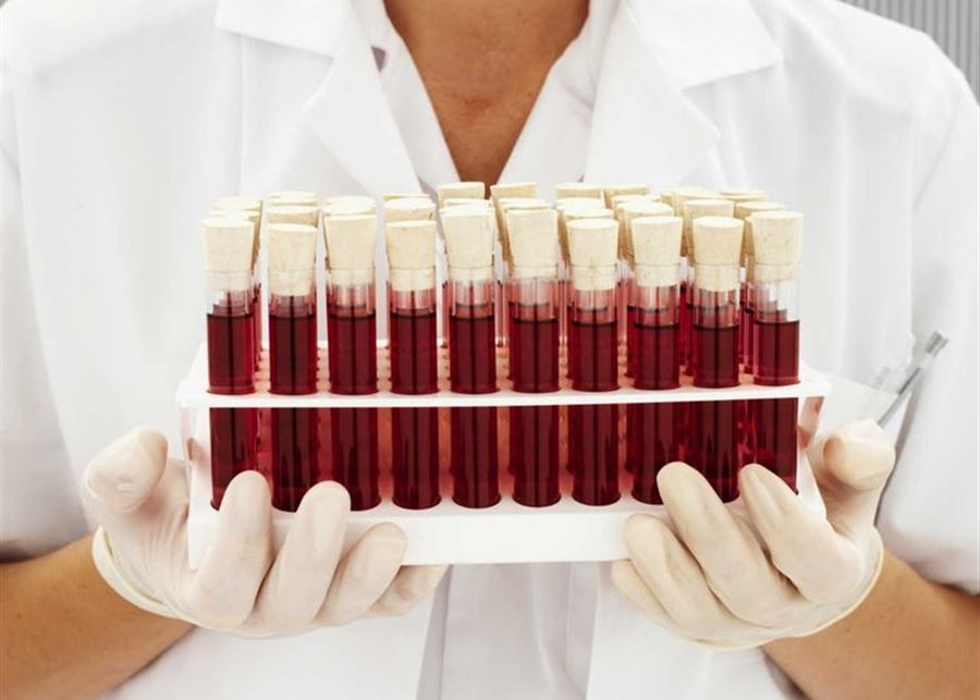 اختبار دم يكتشف 50 نوعًا من السرطان... والنتائج واعدة!