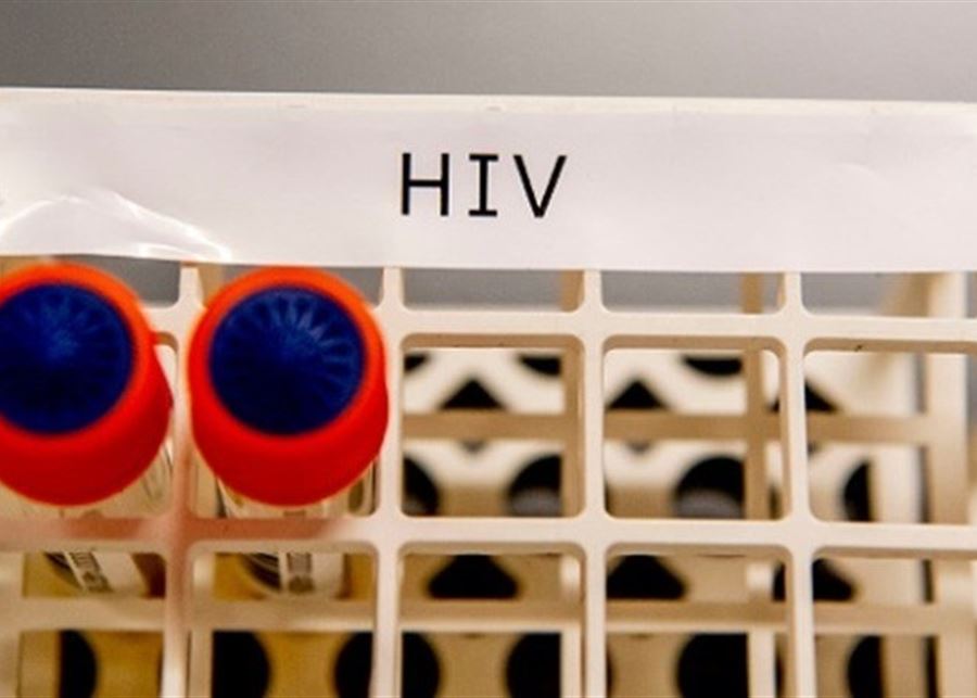   شفاء أول امرأة من فيروس نقص المناعة البشرية