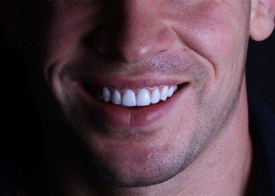 رغبة بالـ hollywood smile... مراهق يخسر اسنانه على يد طبيب بلا ضمير!  